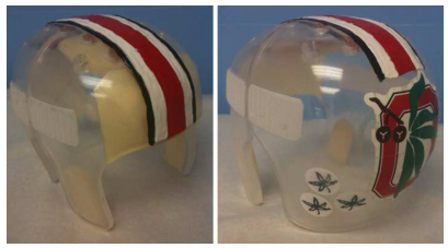 craniosynostosis helmet