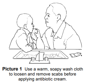 How to loosen a scab with soapy warm water.