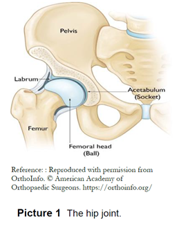 Diagram of hip showing the Pelvis, Labrum, Femoral Head, and Femur