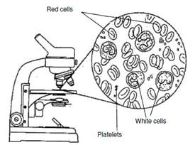 Blood cells and platelets under a microscope