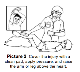 management of ITP at home
