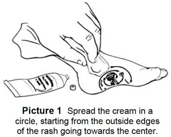 How to Put on the Antifungal Cream