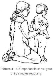 check your child’s moles regularly