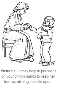put socks on your child’s hands to keep her from scratching the skin open