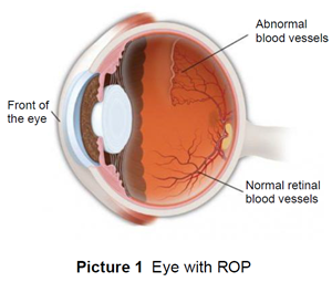 blood vessels in the retina 
