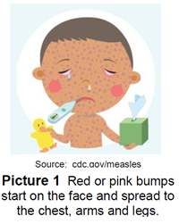 Bumps on child's face, chest, arms, and legs
