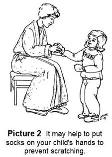 Socks on Hands to Prevent Scratching