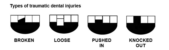 Types of Dental Injuries