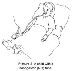 getting ready for surgery