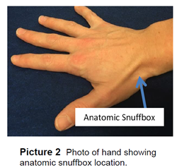 Photo of hand showing  anatomic snuffbox location.