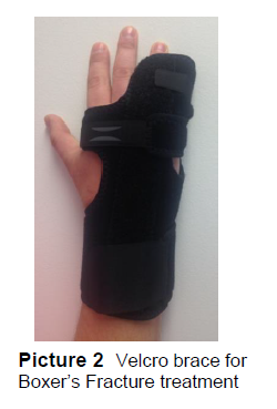 Velcro brace for Boxer's Fracture treatment