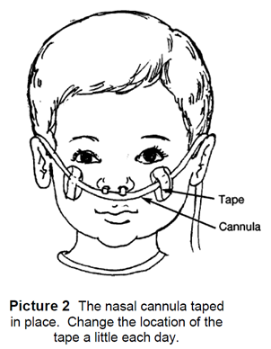 Nasal cannula