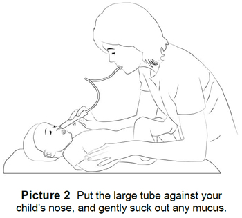 suctioning your child's nose