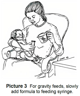 Caregiver feeding baby with gravity syringe
