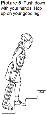 stairs with crutches