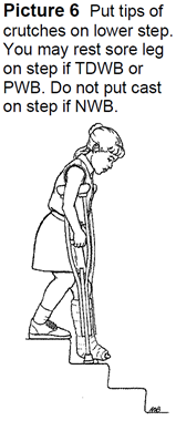 stairs with crutches