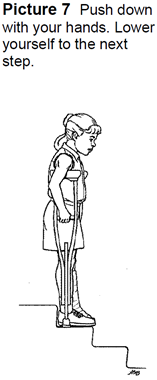 stairs with crutches