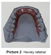 Hawley Retainer