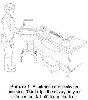 ECG machine