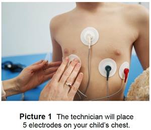 view of the chest showing where electrodes are located