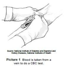 Blood is taken from a vein to do a CBC test