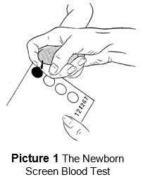 the newborn screen blood test