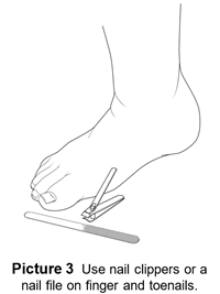Child's foot with nail clippers and nail file.