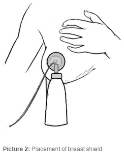 Placement of Breast Shield