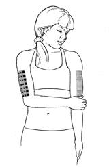 using arms as an injection site