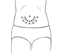 Using the Stomach as an injection spot