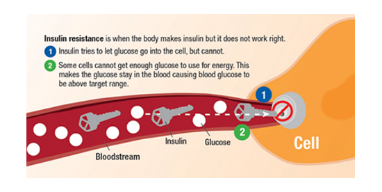 type two diabetes depicted as the cell lock not allowing the insulin key to unlock it for the glucose to enter