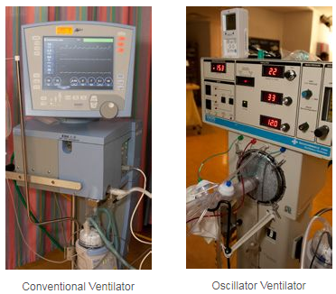 ventilators