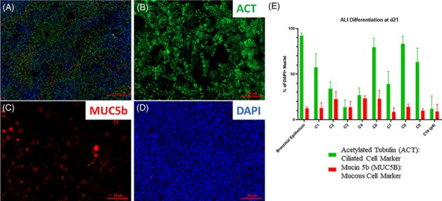 In vitro study of cells for chronic airway disease