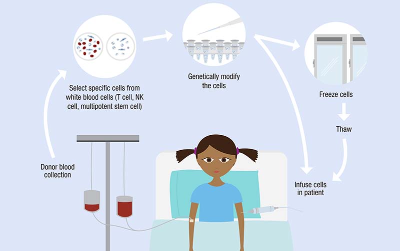 Diagram of natural killer (NK) cell based therapy