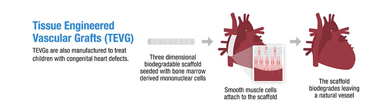 Diagram of Tissue Engineered Vascular Grafts (TEVG)