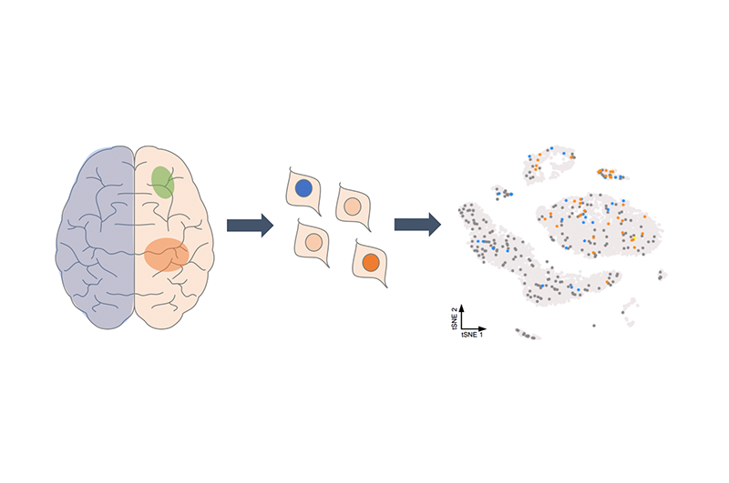 Developmental Brain Malformations