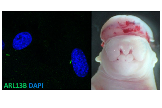 Stottmann Lab Current Projects