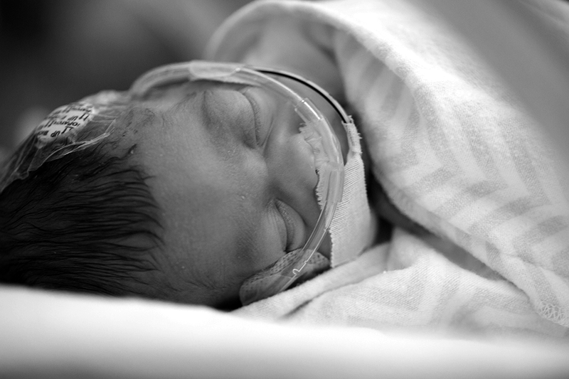 Neonatal Intensive Care