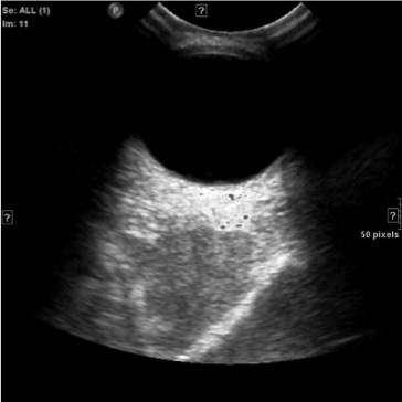 James Murakami, MD presentation