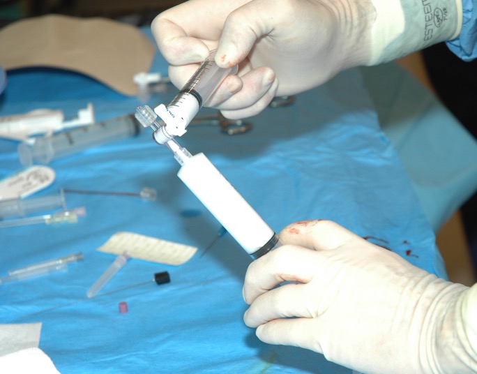 Foam ready for injection