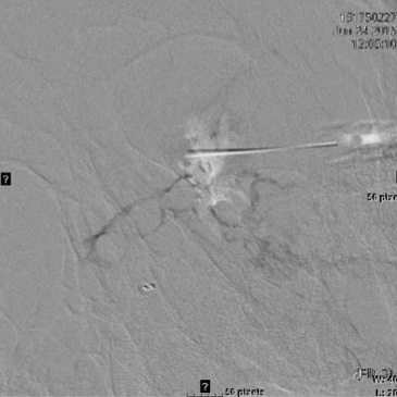 James Murakami, MD presentation