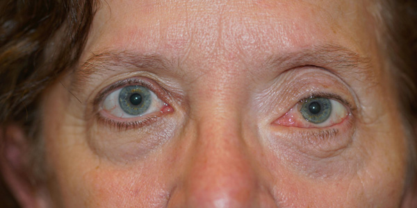 James Murakami, MD presentation