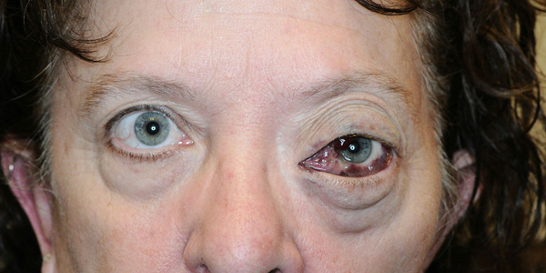 James Murakami, MD presentation