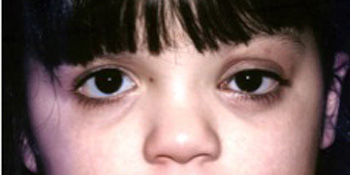 James Murakami, MD presentation