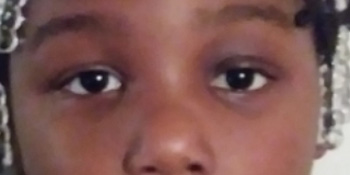 James Murakami, MD presentation